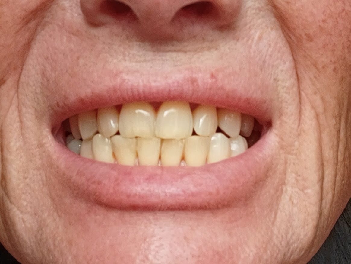 Customer photo review of Teeth Whitening Powder