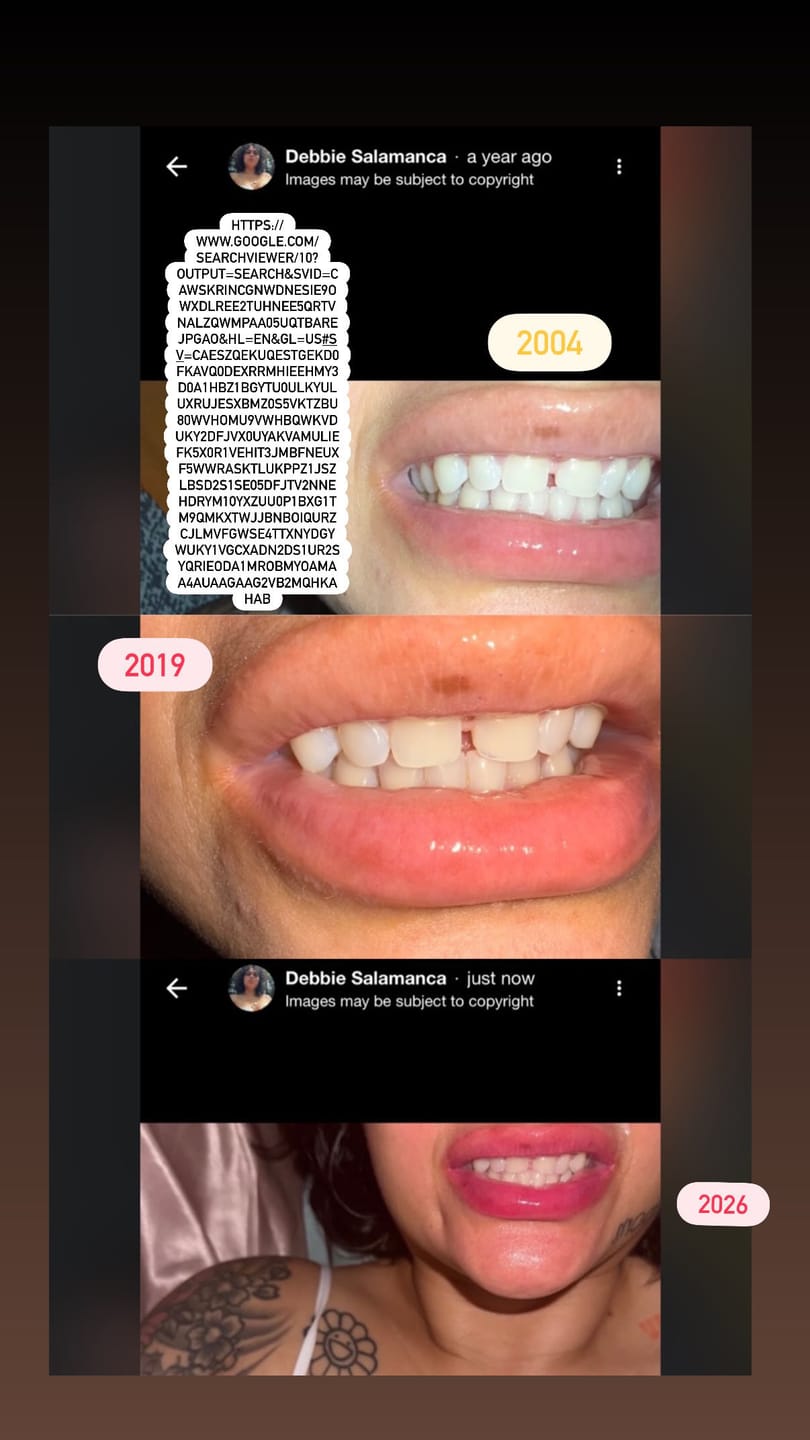 Customer photo review of 2X EXTREME PLUMPER WITH TINT