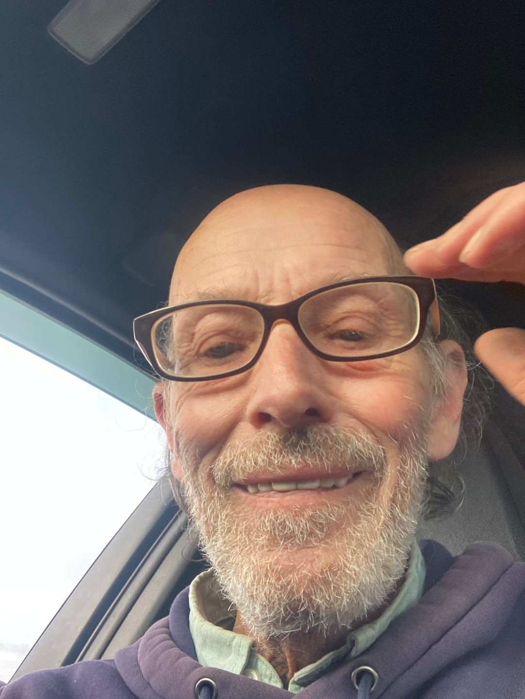 Customer photo review of Click-in Veneers 4.0