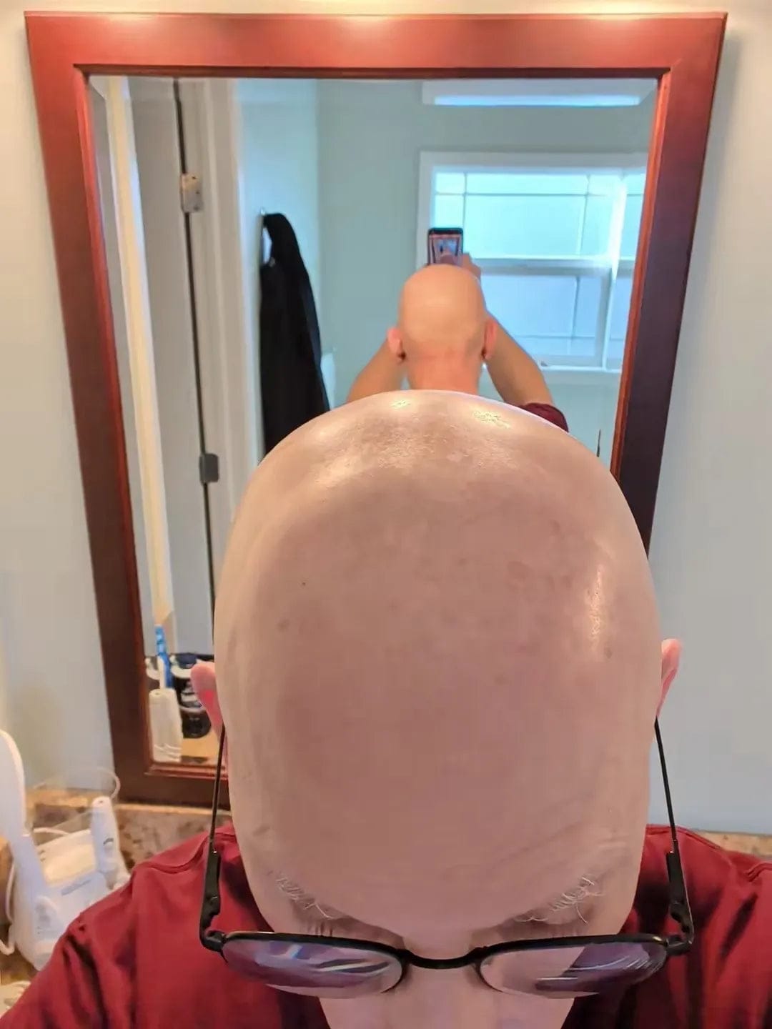 Customer photo review of Hair Removal Cream Made for face + scalp