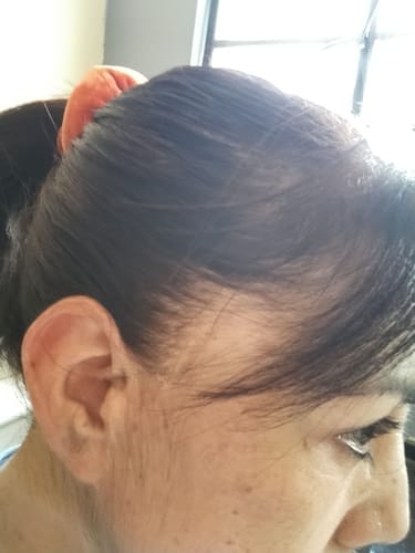 Customer photo review of HENRIC X5
