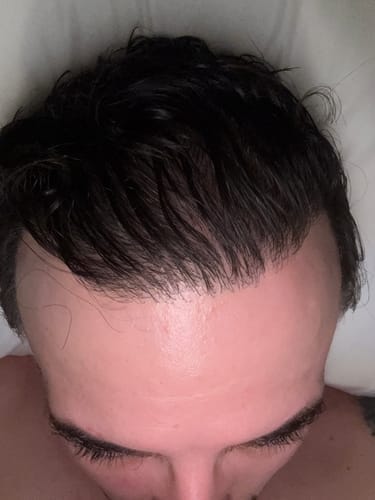 Customer photo review of HENRIC X5