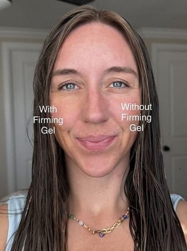 Customer photo review of Instant Eye Lift Duo