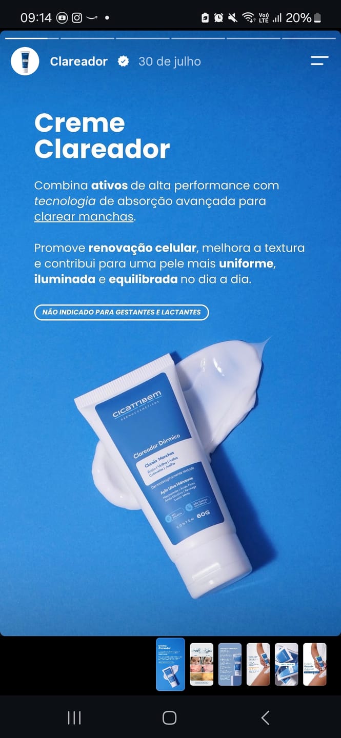 Customer photo review of Creme Clareador de Manchas – Melasma, Axilas, Virilha, Áreas Íntimas, Rosto e Corpo