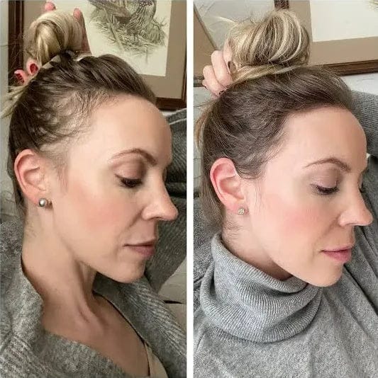 Customer photo review of Scaléa | Peigne Massant & Applicateur de Soin pour Cuir Chevelu