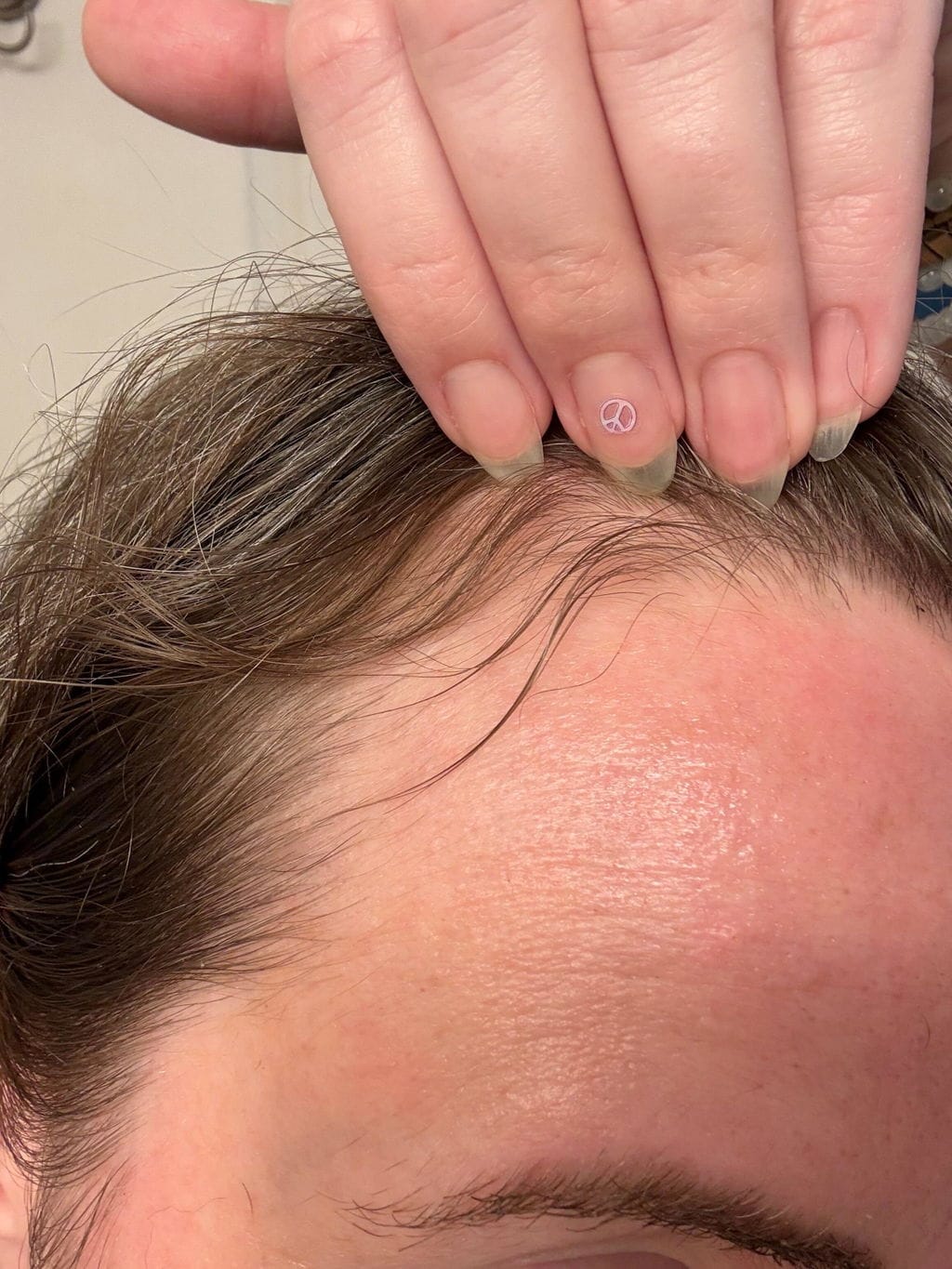 Customer photo review of Onion Hydrosol Shower Duo