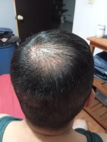 Customer photo review of HENRIC X5