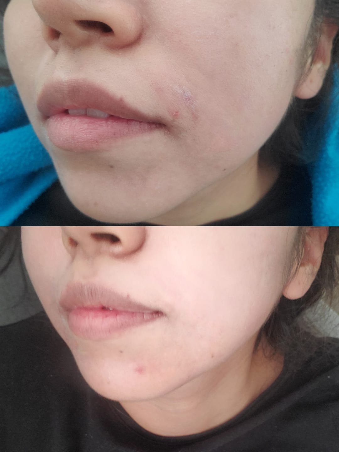 Customer photo review of Madeca Cream Time Reverse 50ml
