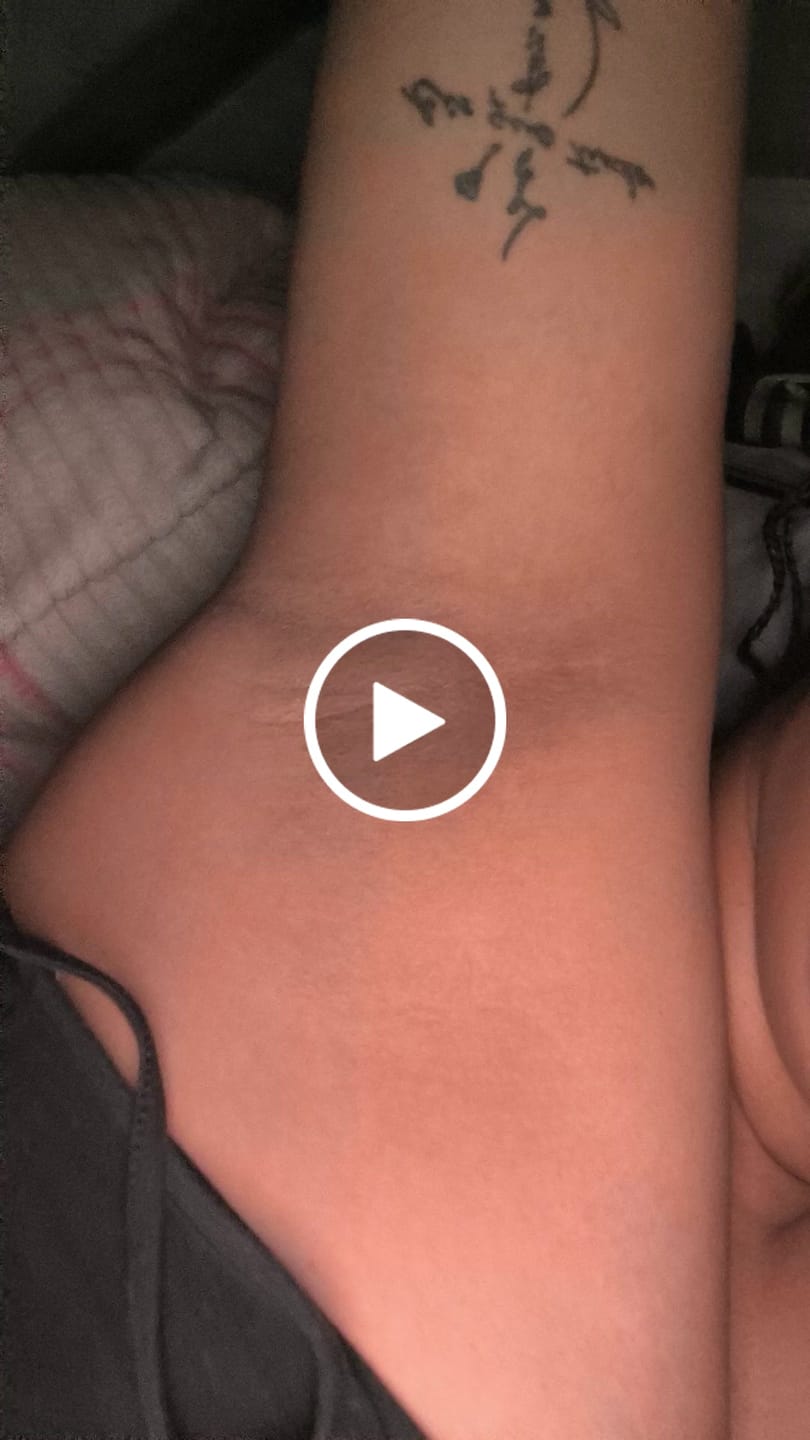 Customer video review of Creme Clareador de Manchas – Melasma, Axilas, Virilha, Áreas Íntimas, Rosto e Corpo