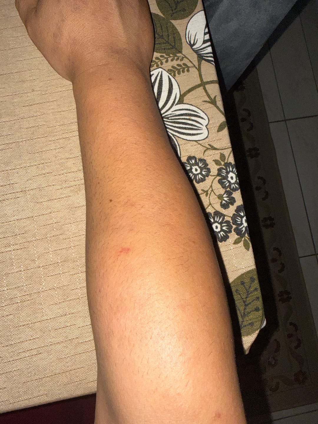 Customer photo review of Creme Clareador de Manchas – Melasma, Axilas, Virilha, Áreas Íntimas, Rosto e Corpo