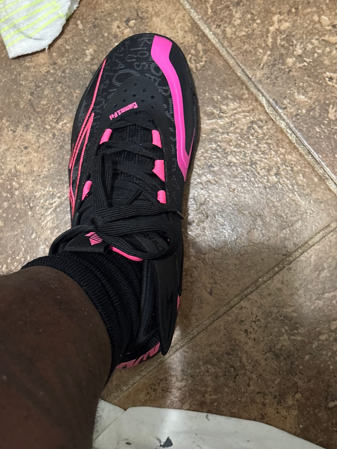 Customer photo review of Game1 Hi MVP