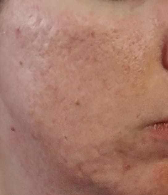 Customer photo review of Repair Hemp & Retinol Face  & Body Wash