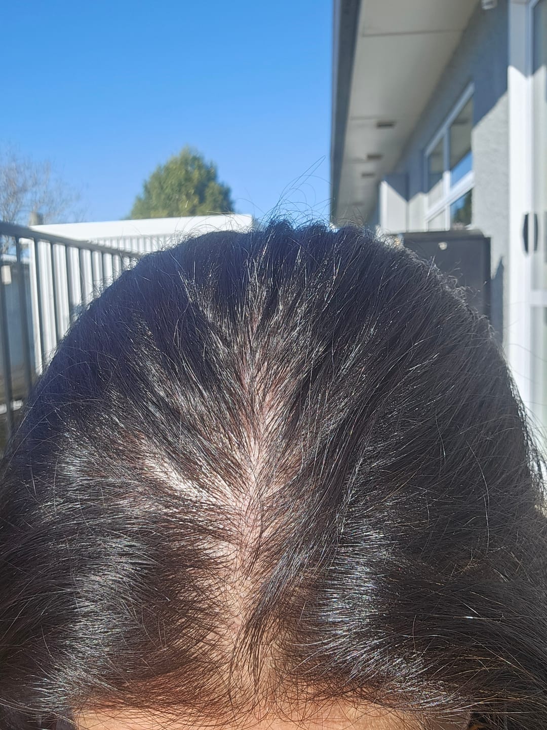 Customer photo review of VITAFOAM ™ Hair Growth Formula