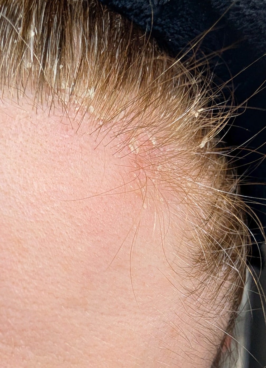 Customer photo review of Seb Natural Calming Serum
