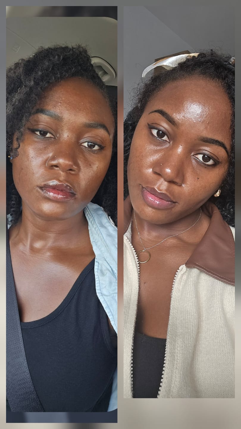 Customer photo review of The Gold Glo Supplement System/Duo Gélules