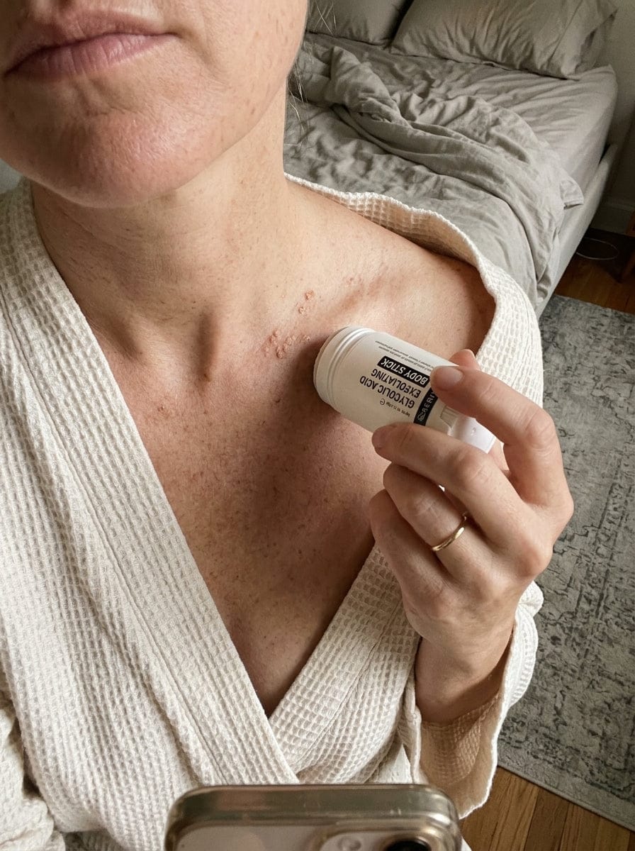 Customer photo review of Serivalo™ Glycolic Acid Exfoliating Body Stick