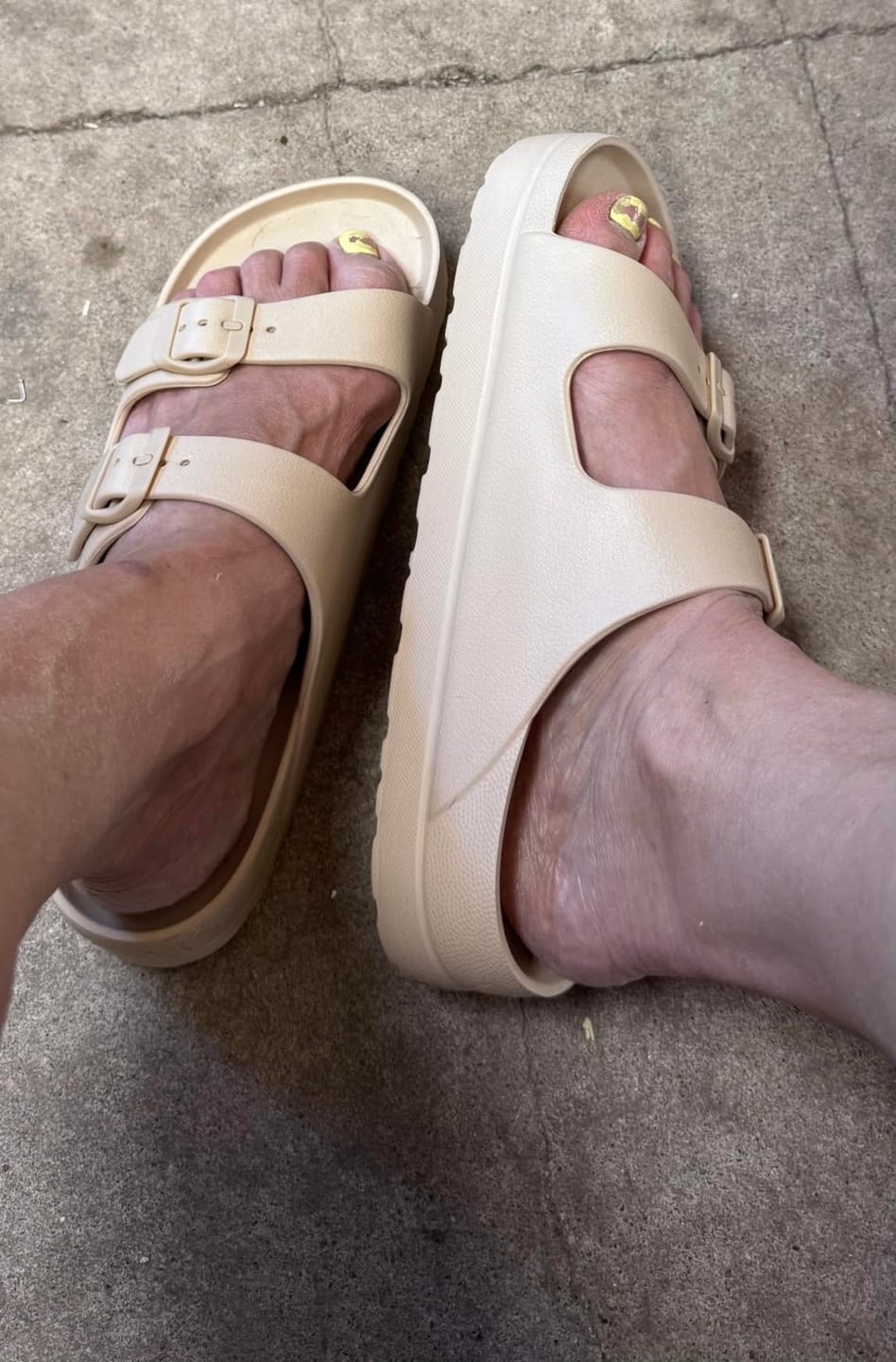 Customer photo review of Snuggi Arch Support Platfrom Sandals