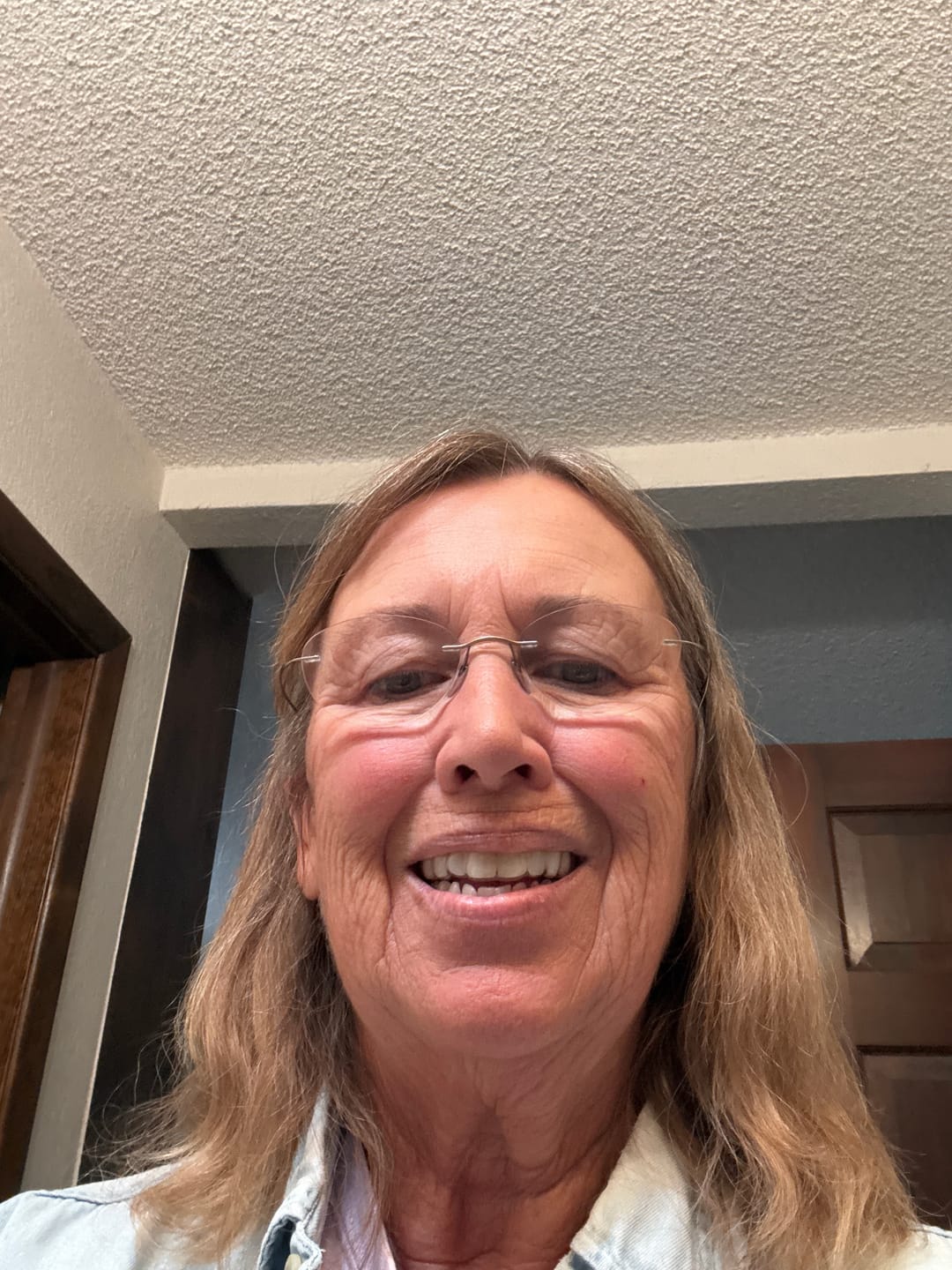 Customer photo review of Clear Custom Night Guard