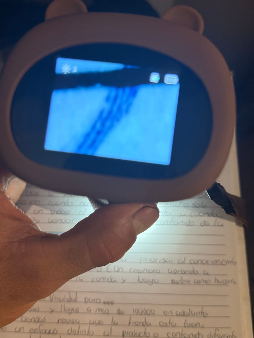 Customer photo review of Microscopio de bolsillo para niños aumento 1000X