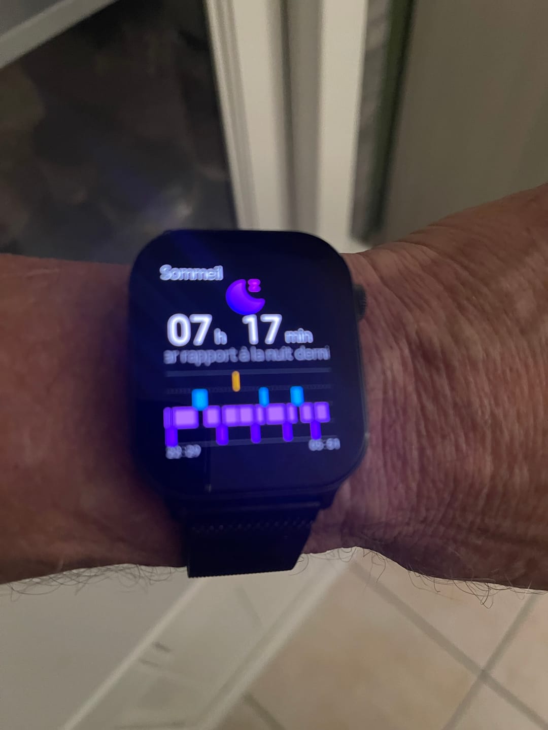 Customer photo review of GARD PRO SANTÉ 4