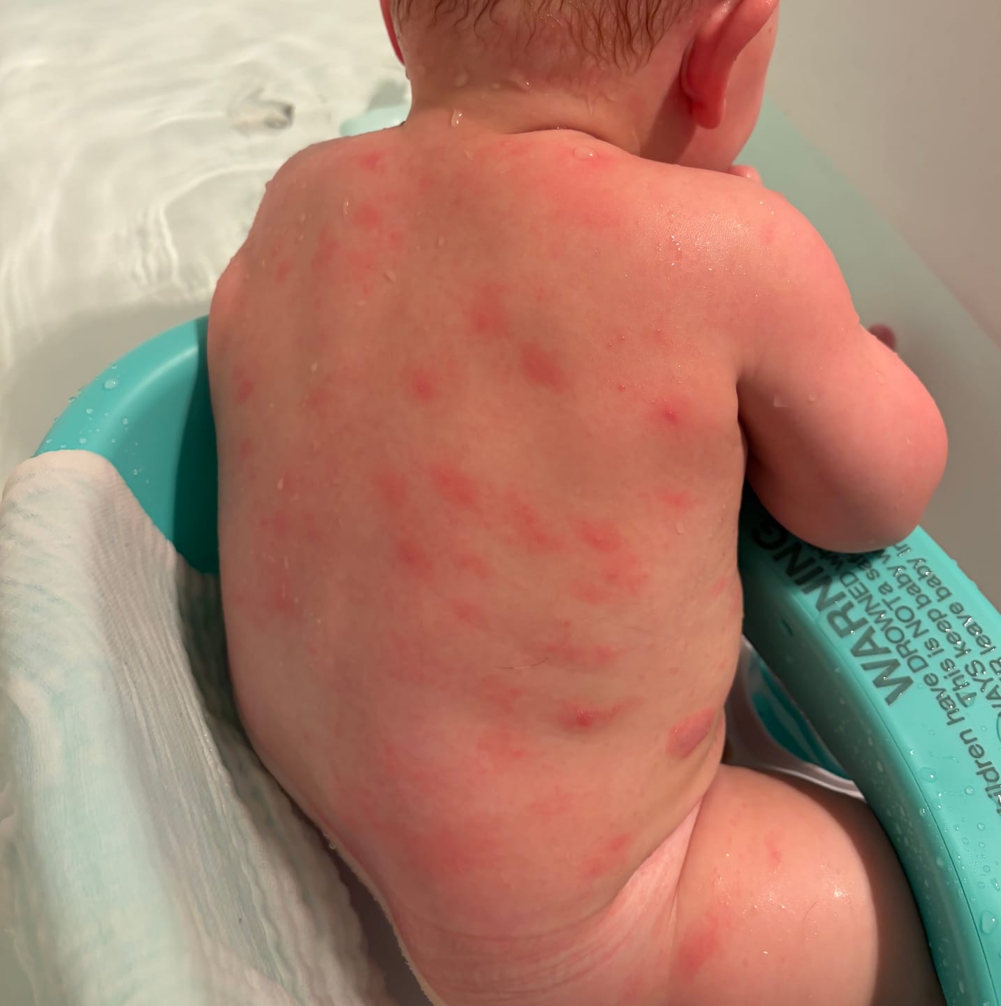 Customer photo review of Baby Balm