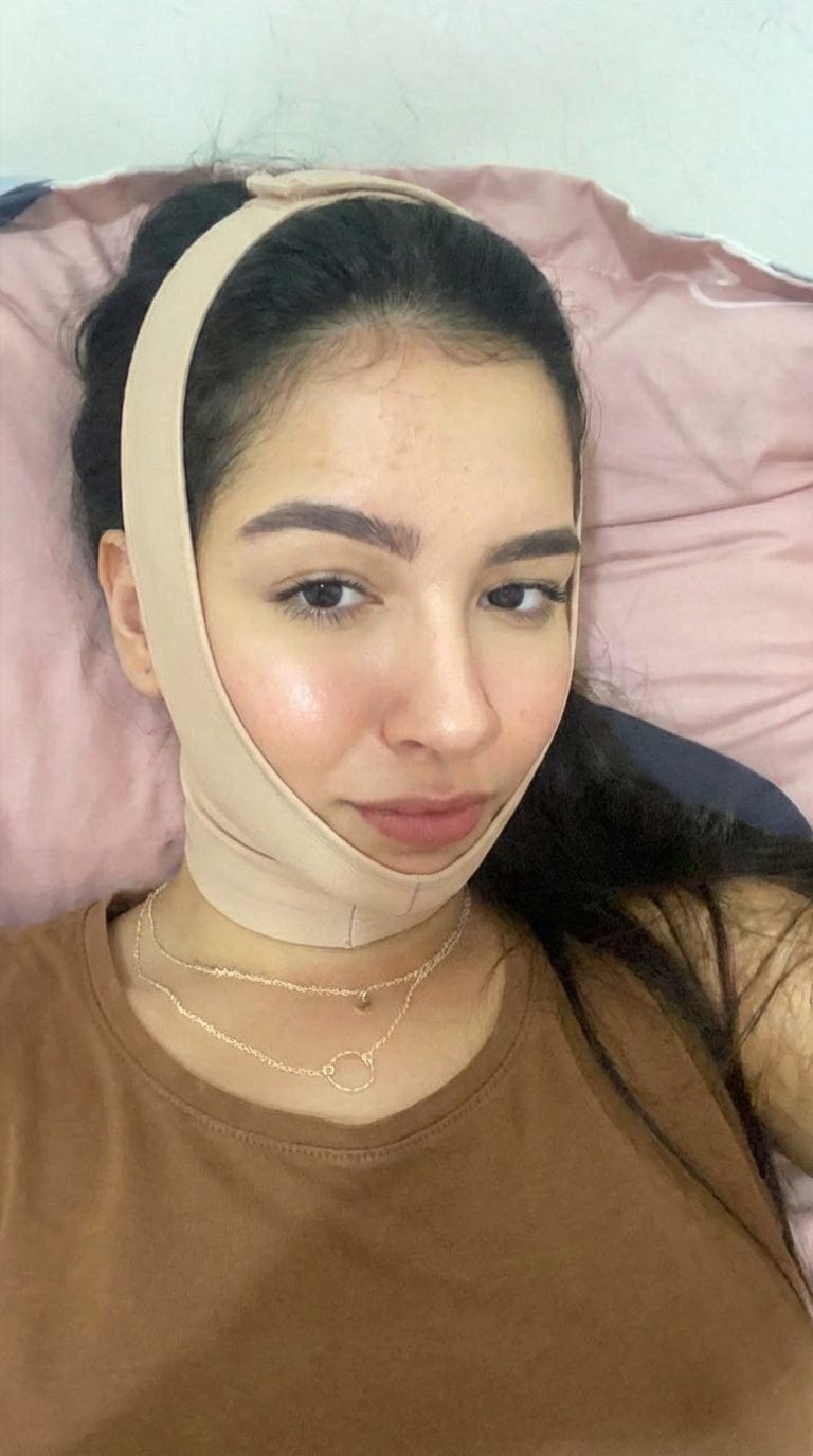 Customer photo review of Kolajen Yüz ve Çene Şekillendirici