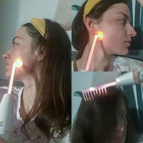 Customer photo review of NovaSculpt Glow — Alta Frecuencia para Piel Radiante y Sin Acné