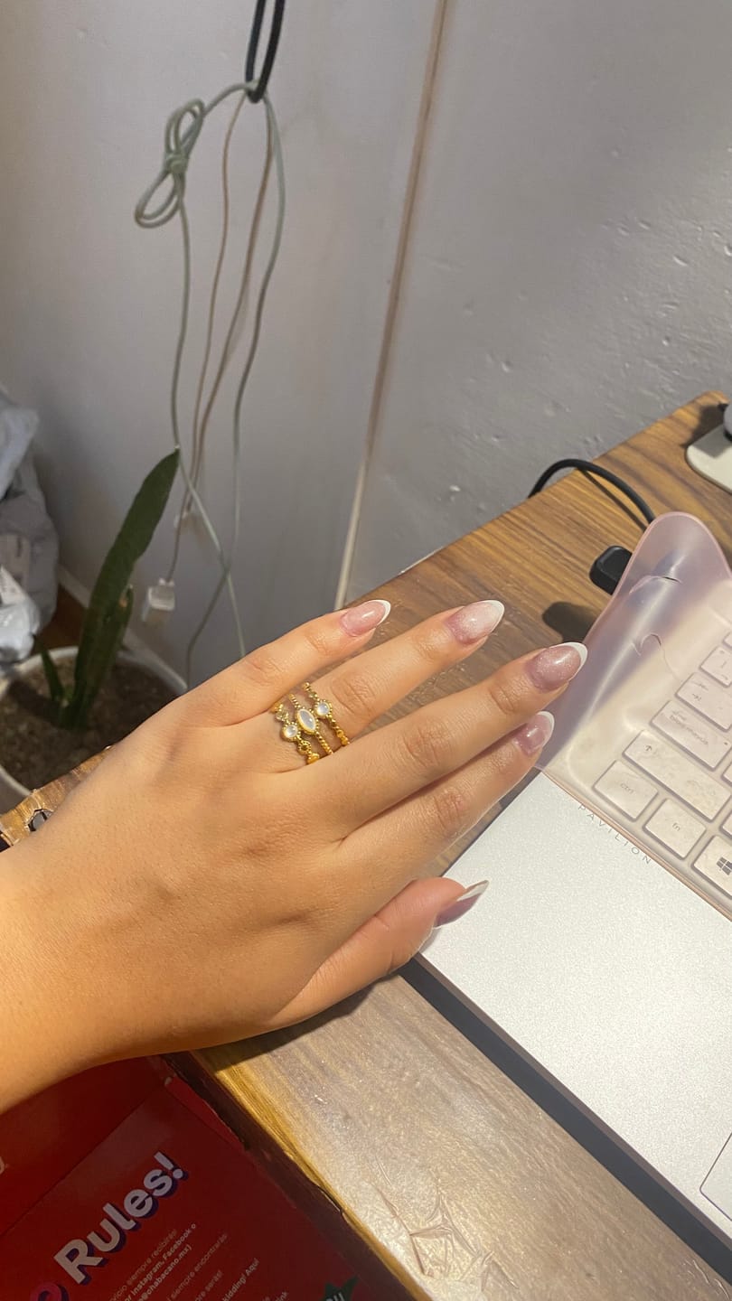 Customer photo review of Anillo Ajustable Albo