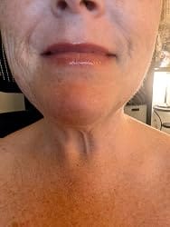 Customer photo review of GlossMuse™ Hydrating Lip Gloss
