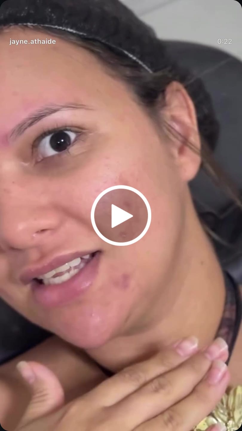 Customer video review of Primer Grip Fix - Vizzela