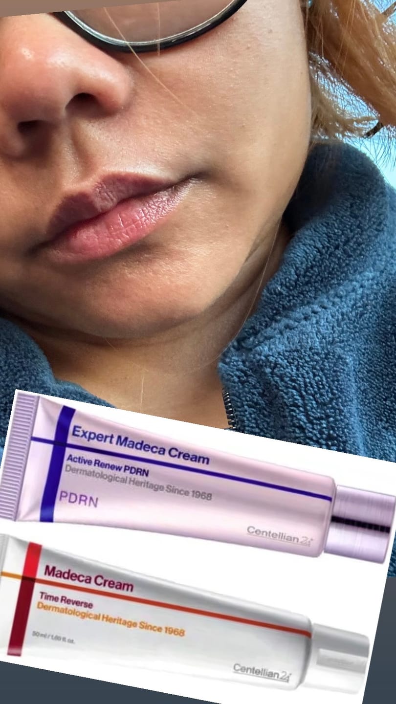Customer photo review of Madeca Cream Best Duo