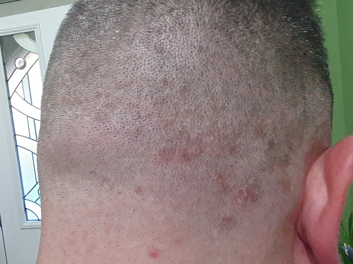 Customer photo review of Seb Natural Calming Serum