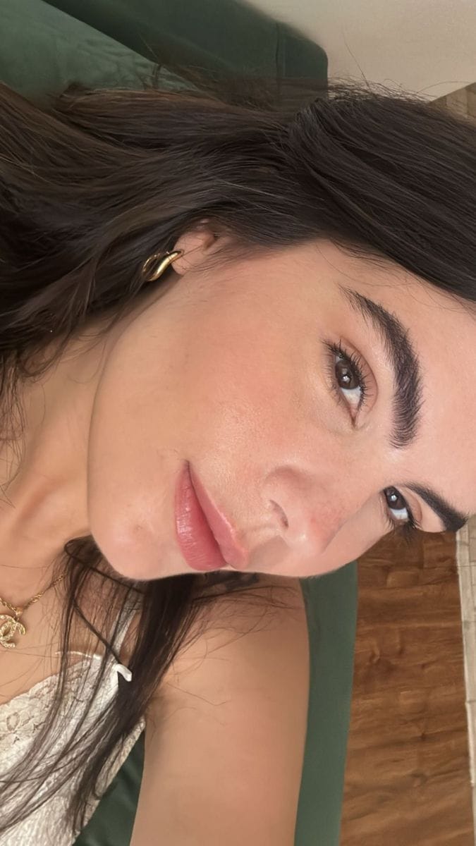 Customer photo review of NovaSculpt Glow — Alta Frecuencia para Piel Radiante y Sin Acné
