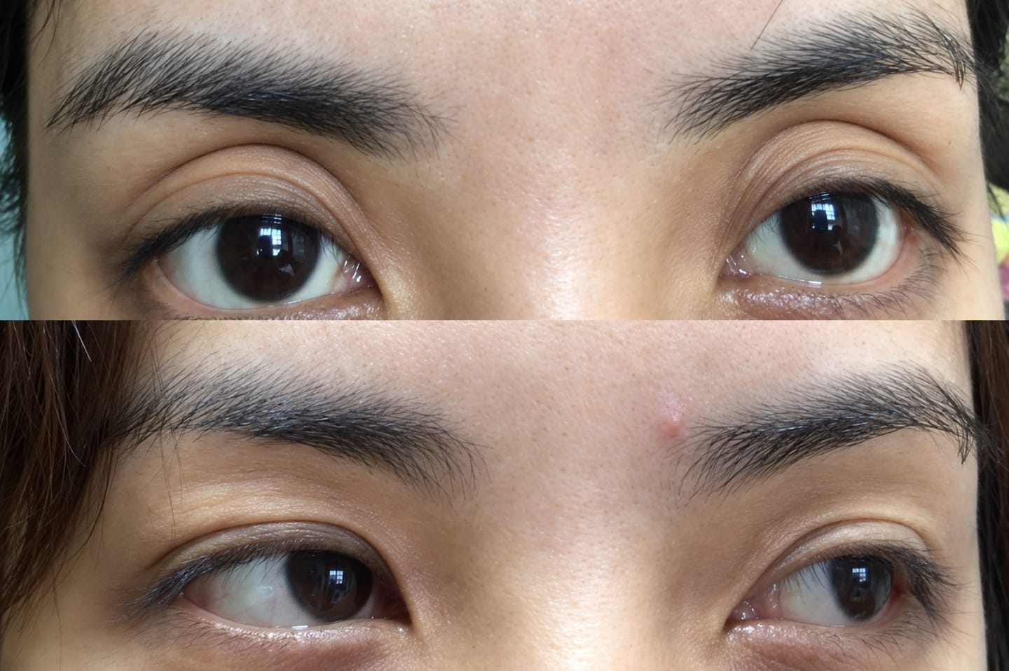 Customer photo review of Optifold EyelidShaping™ Tapes (Standard Pack)