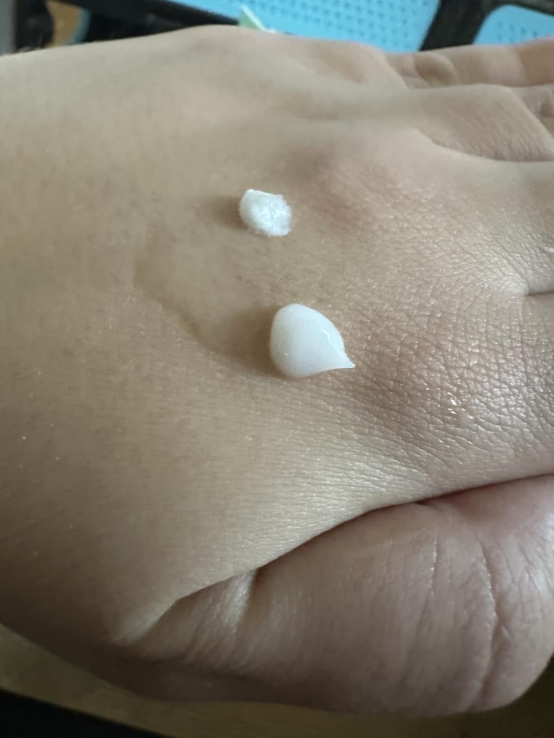 Customer photo review of Clear Complexion Skincare Set