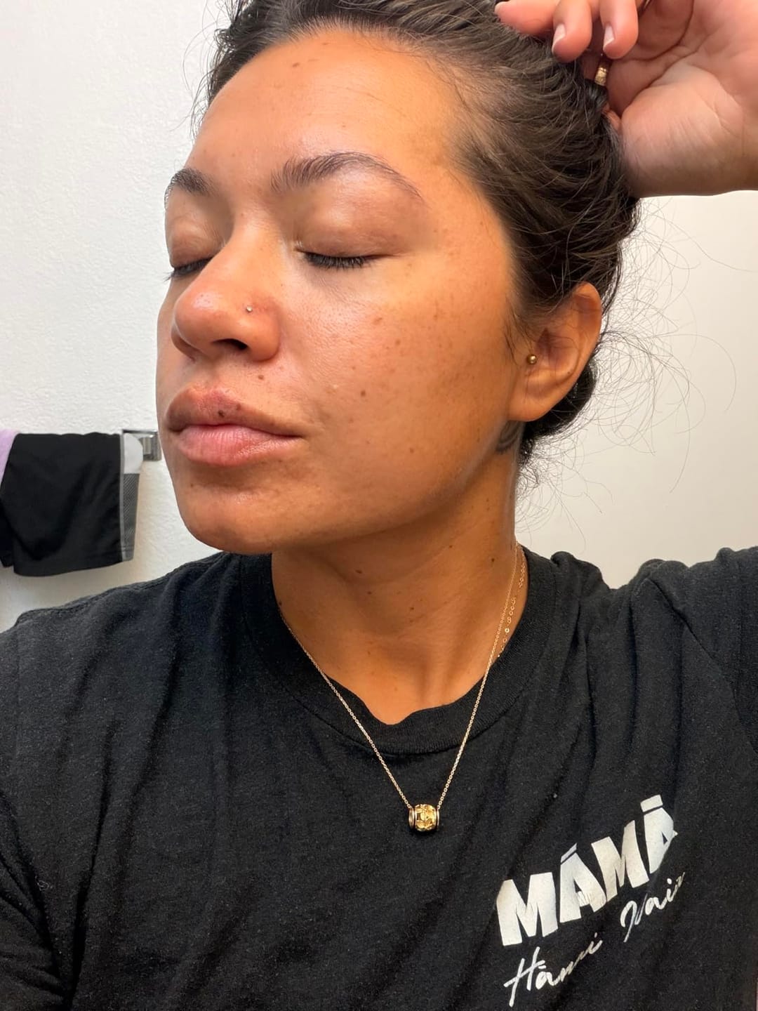 Customer photo review of Clear Complexion Skincare Set