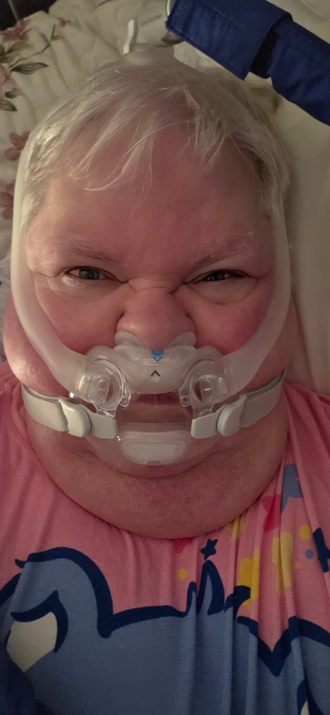 Customer photo review of ResMed AirFit™ X30i Pillow Cushion