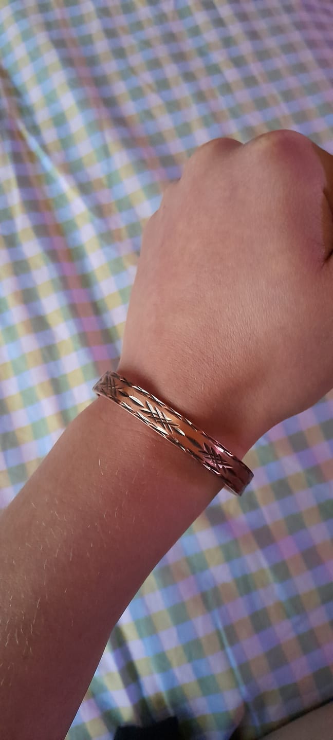 Customer photo review of Copper Band Barb  #cb6