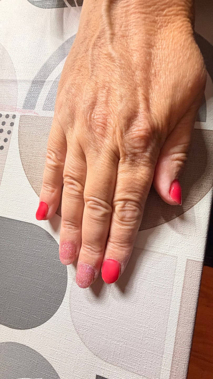 Customer photo review of Glowdip Alles-in-één Manicure Set
