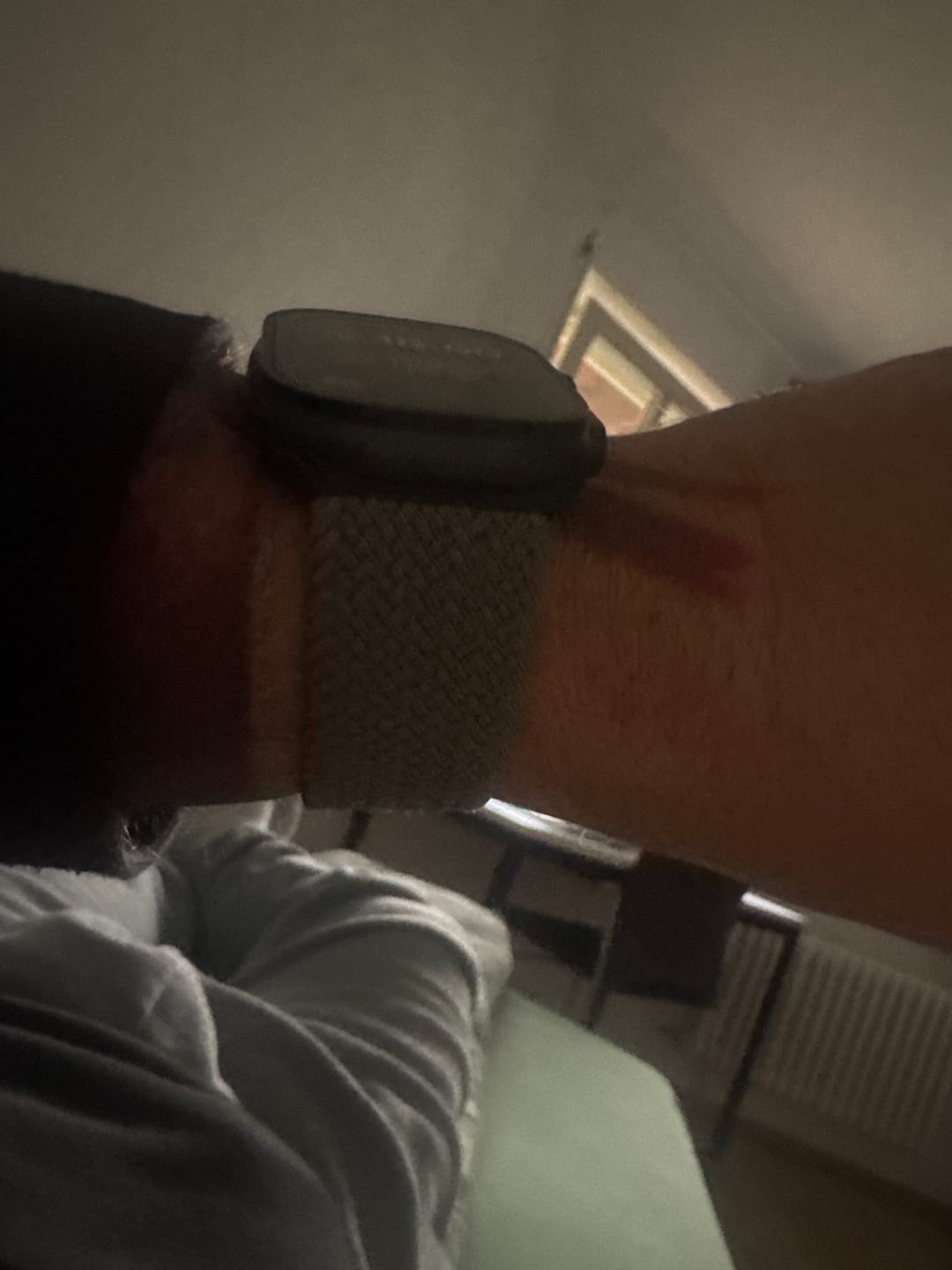 Customer photo review of arktisband Geflochtenes Apple Watch Ultra Armband "Casual" mit Magnetverschluss