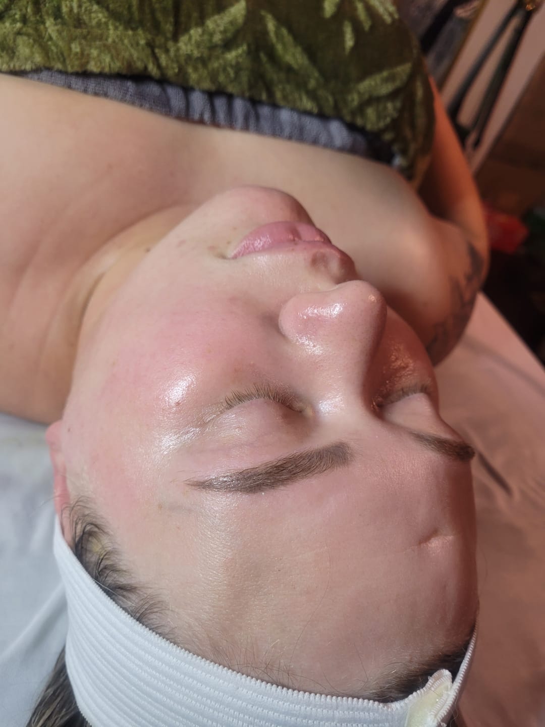 Customer photo review of Vitamin C Peel Activator - Liquid