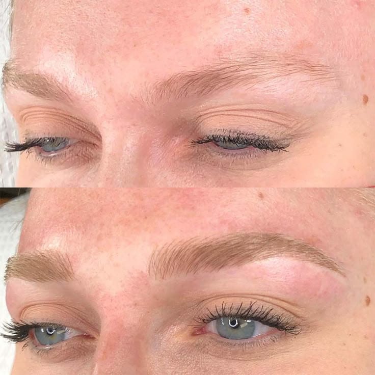 Customer photo review of Eyebrow Growth Kit