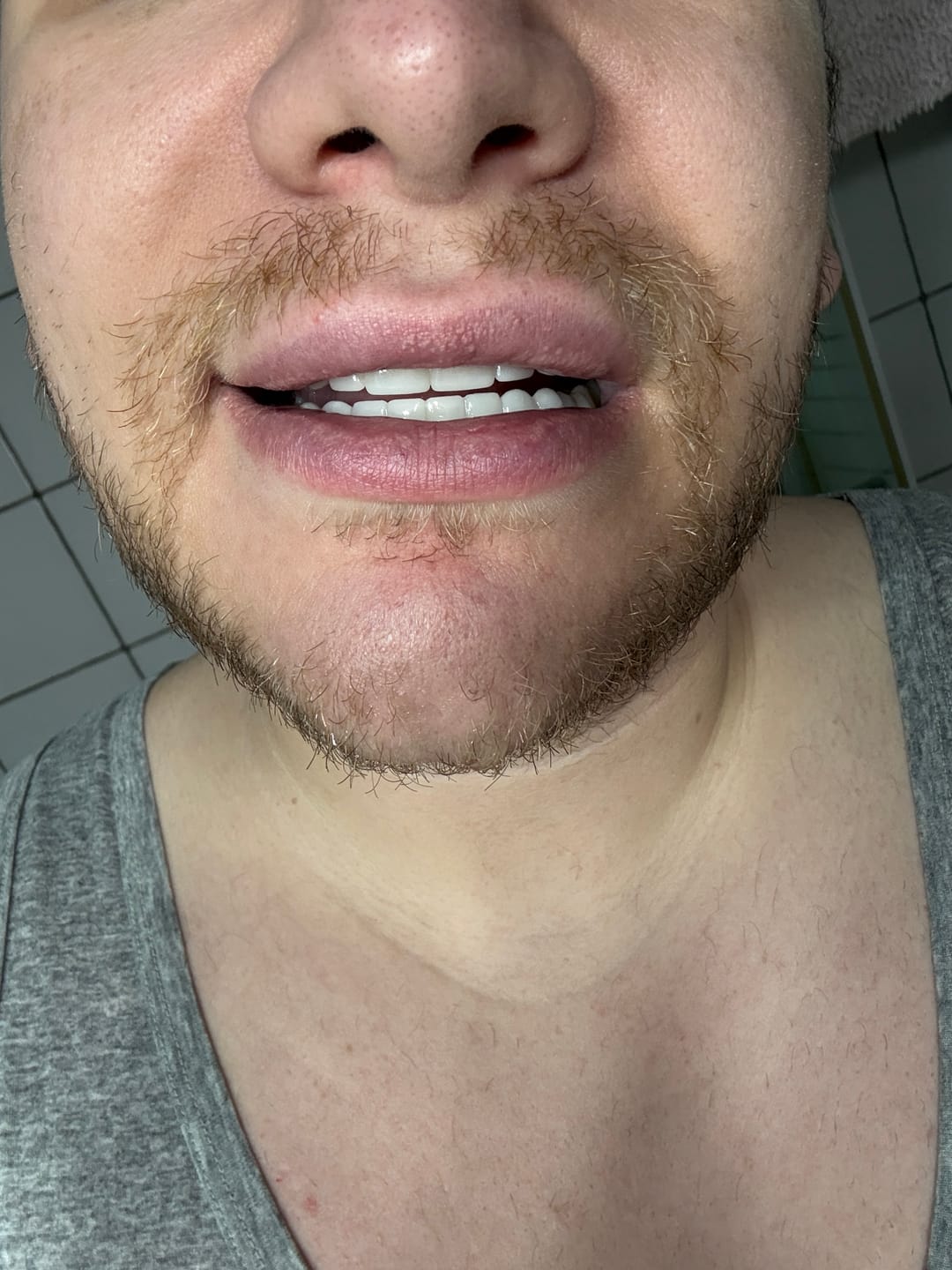 Customer photo review of Faccette-Dentali 3.0