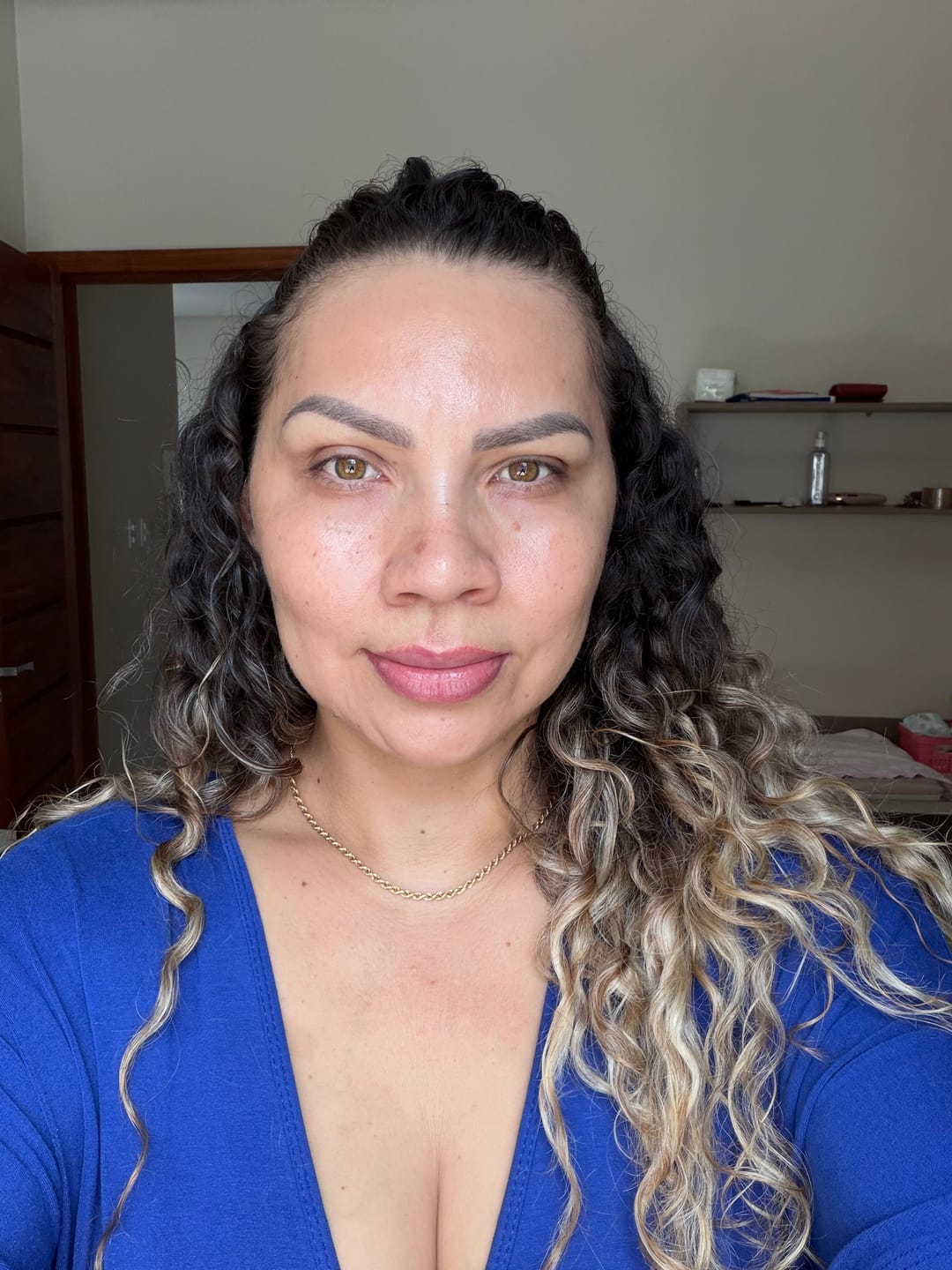 Customer photo review of Creme Clareador de Manchas – Melasma, Axilas, Virilha, Áreas Íntimas, Rosto e Corpo