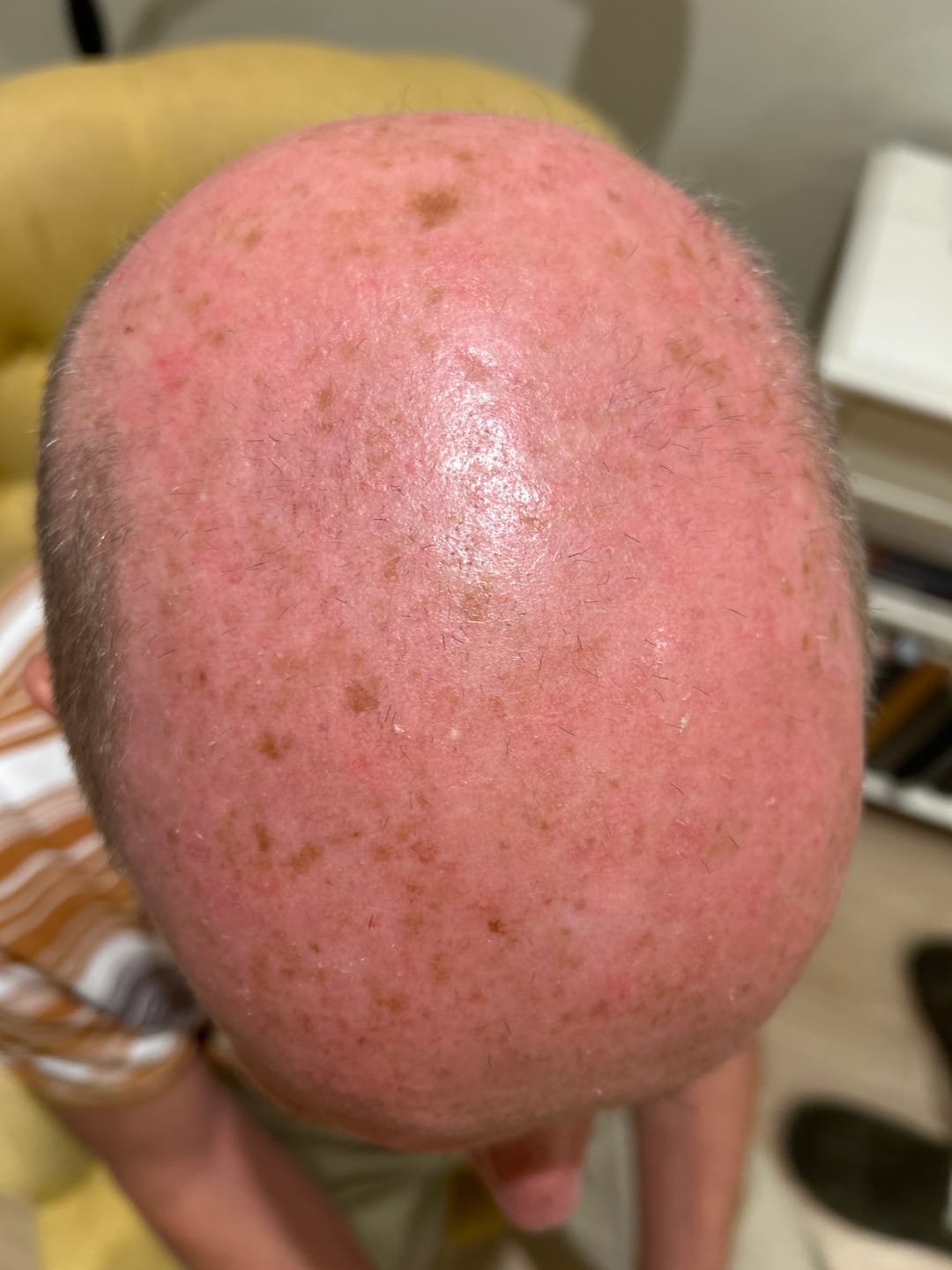 Customer photo review of Seb Natural Calming Serum