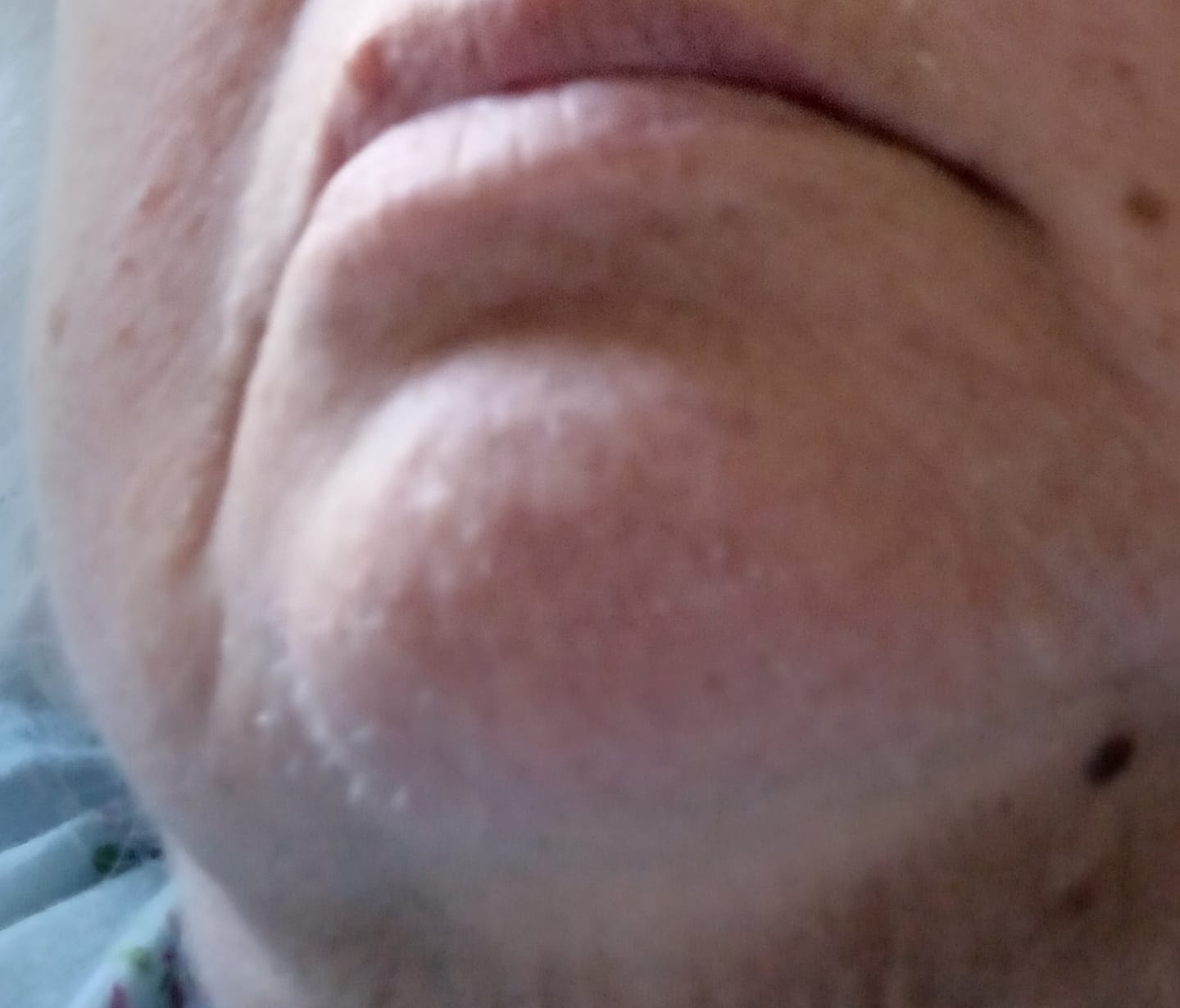 Customer photo review of Painless Hair Removal Cream