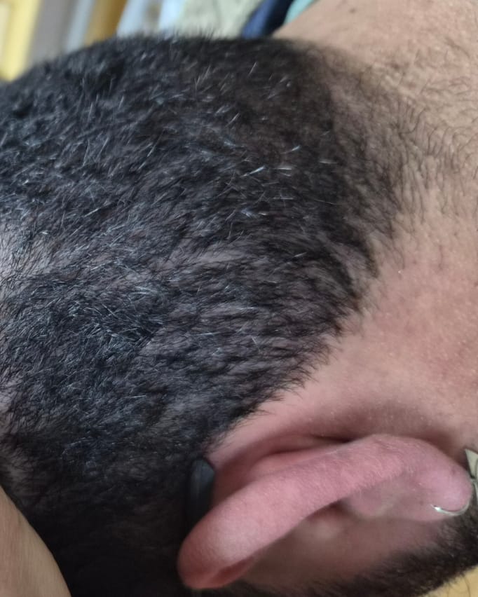 Customer photo review of Shampoo Anticaspa en barra · 70 g (XL)