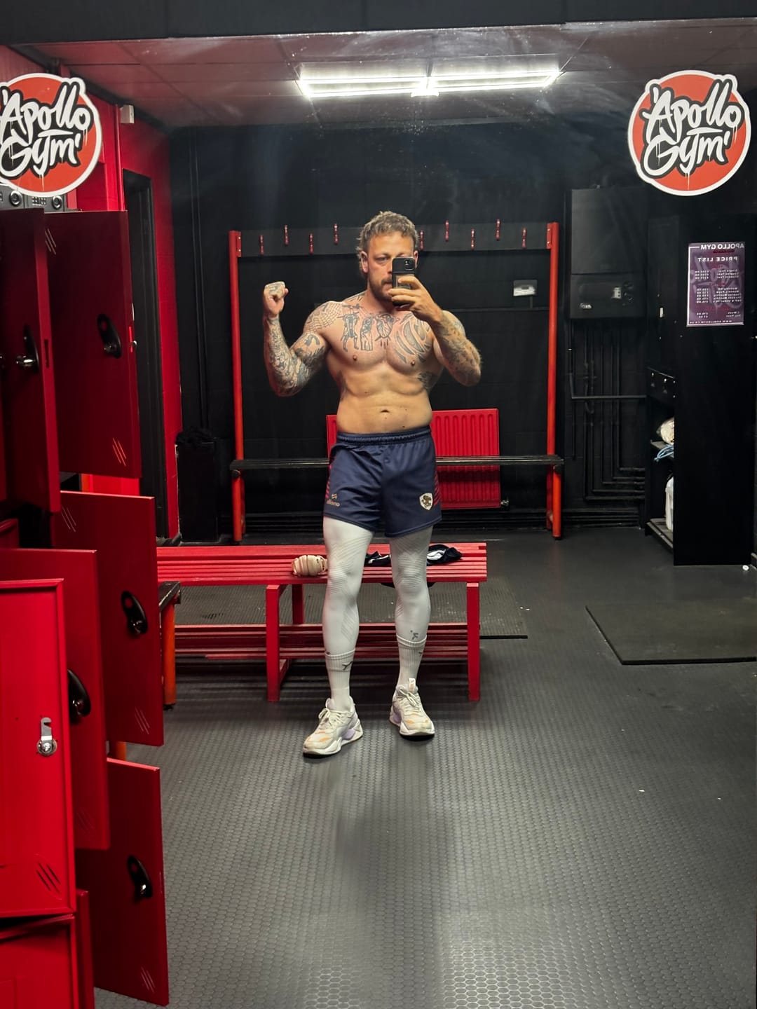 Customer photo review of KniTec V2 - Compression Sleeves For Knees & Legs