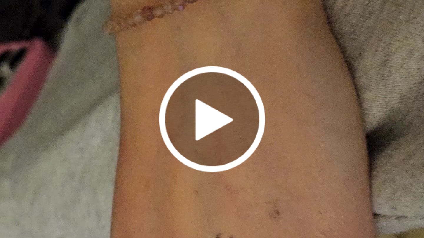 Customer video review of Rosenquarz Armband - Perlen