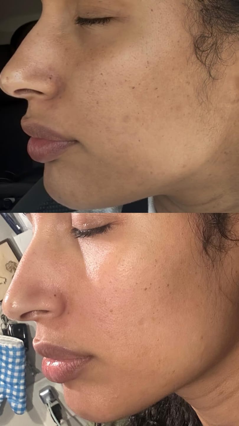 Customer photo review of Anua 77% Soothing Toner For Skin